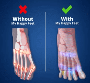 My-Happy-Feet-Socks-Before-And-After